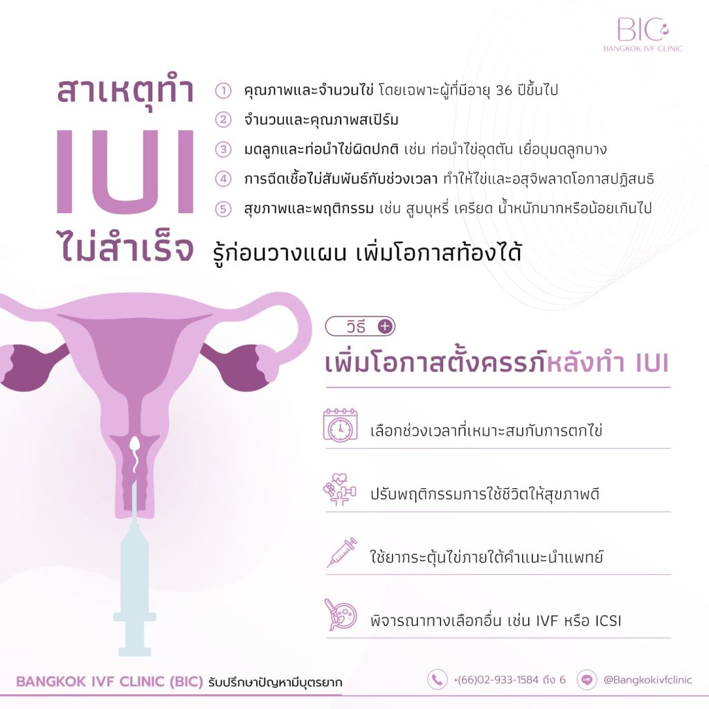 สาเหตุที่ทำให้ IUI ไม่ติดและแนวทางเพิ่มโอกาสตั้งครรภ์หลังทำ IUI