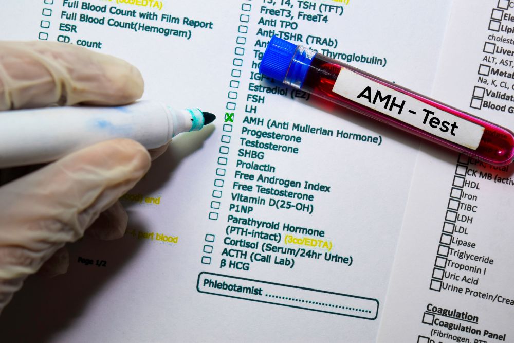 Before addressing low AMH levels, it's necessary to check your AMH count so your doctor can plan appropriate treatment.