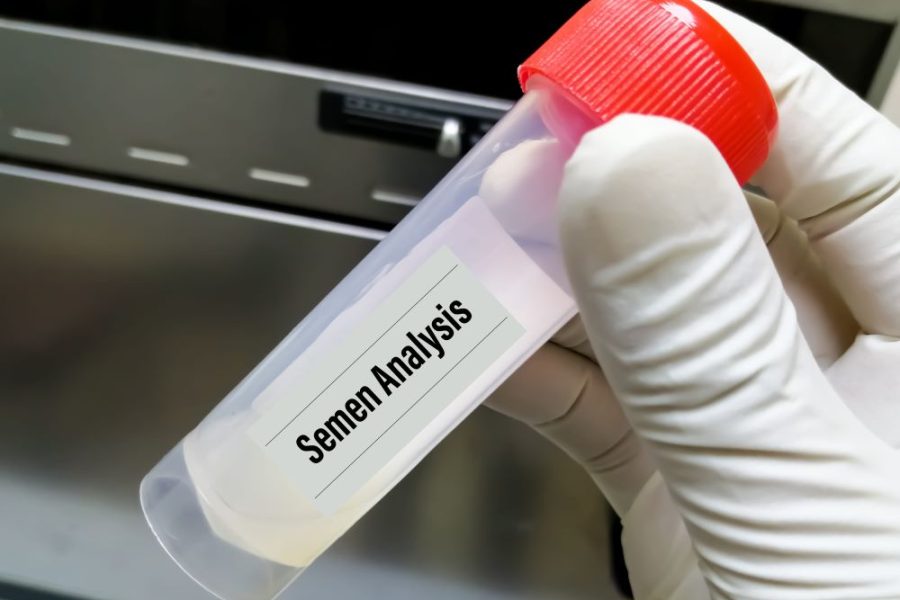 Azoospermia คือภาวะไม่มีอสุจิและแนวทางรักษาภาวะมีบุตรยากในผู้ชาย