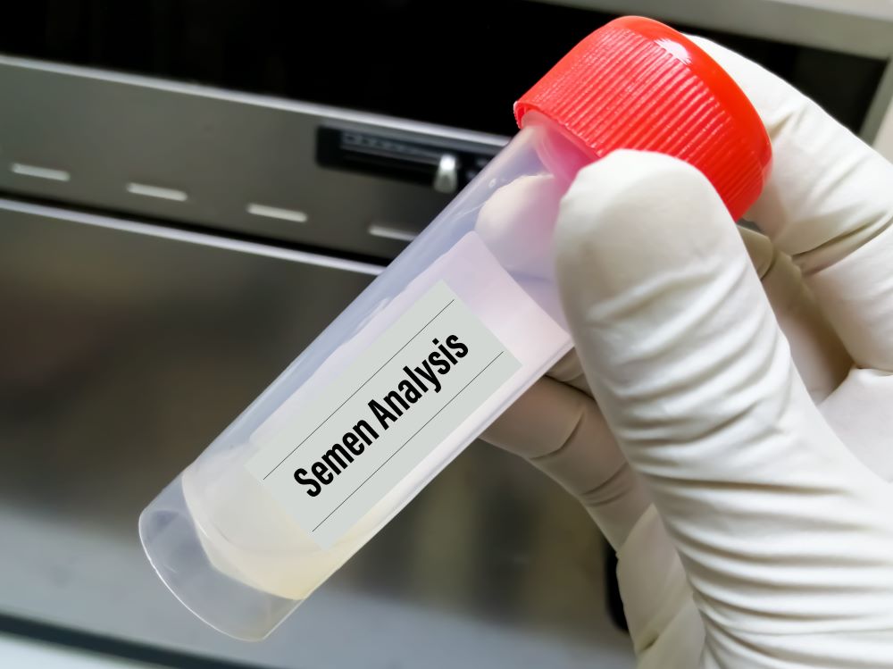 Azoospermia คือภาวะไม่มีอสุจิและแนวทางรักษาภาวะมีบุตรยากในผู้ชาย